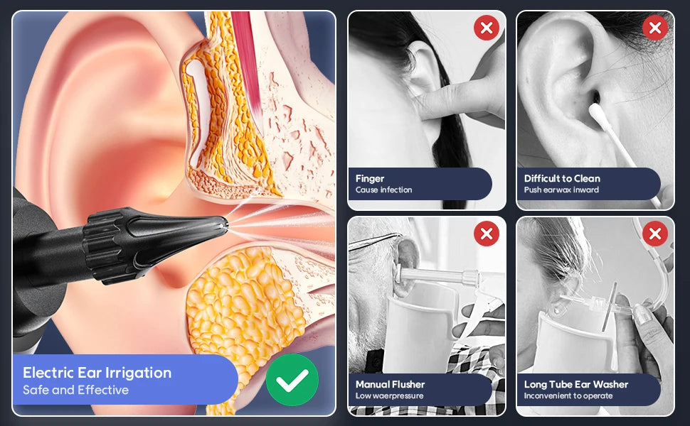 Elektrische Ohrenreiniger-Kit mit 4 Druckmodi - Ohrenschmalz Entfernung mit Wasserspülung für optimale Hygiene & Pflege!